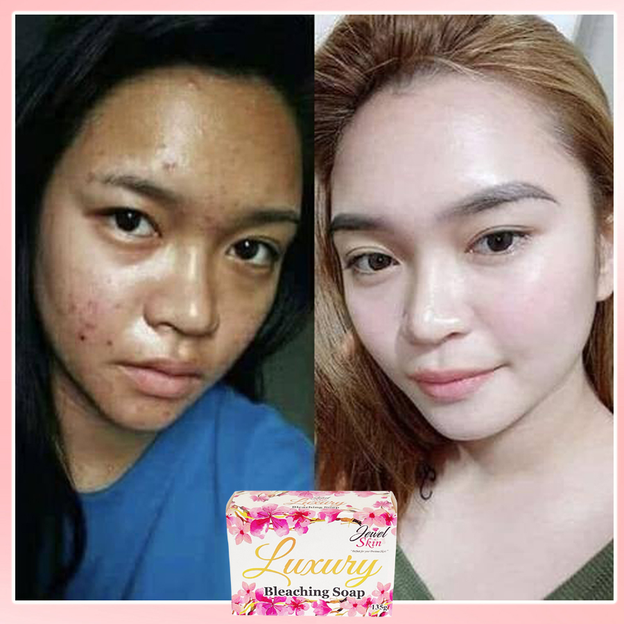 Jewel Skin Bleaching Soap Effective jewel skin Bleaching Glutathione