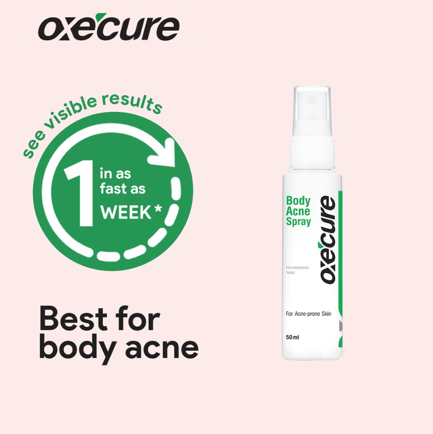 OXECURE Body Acne Spray 50ml Lazada PH