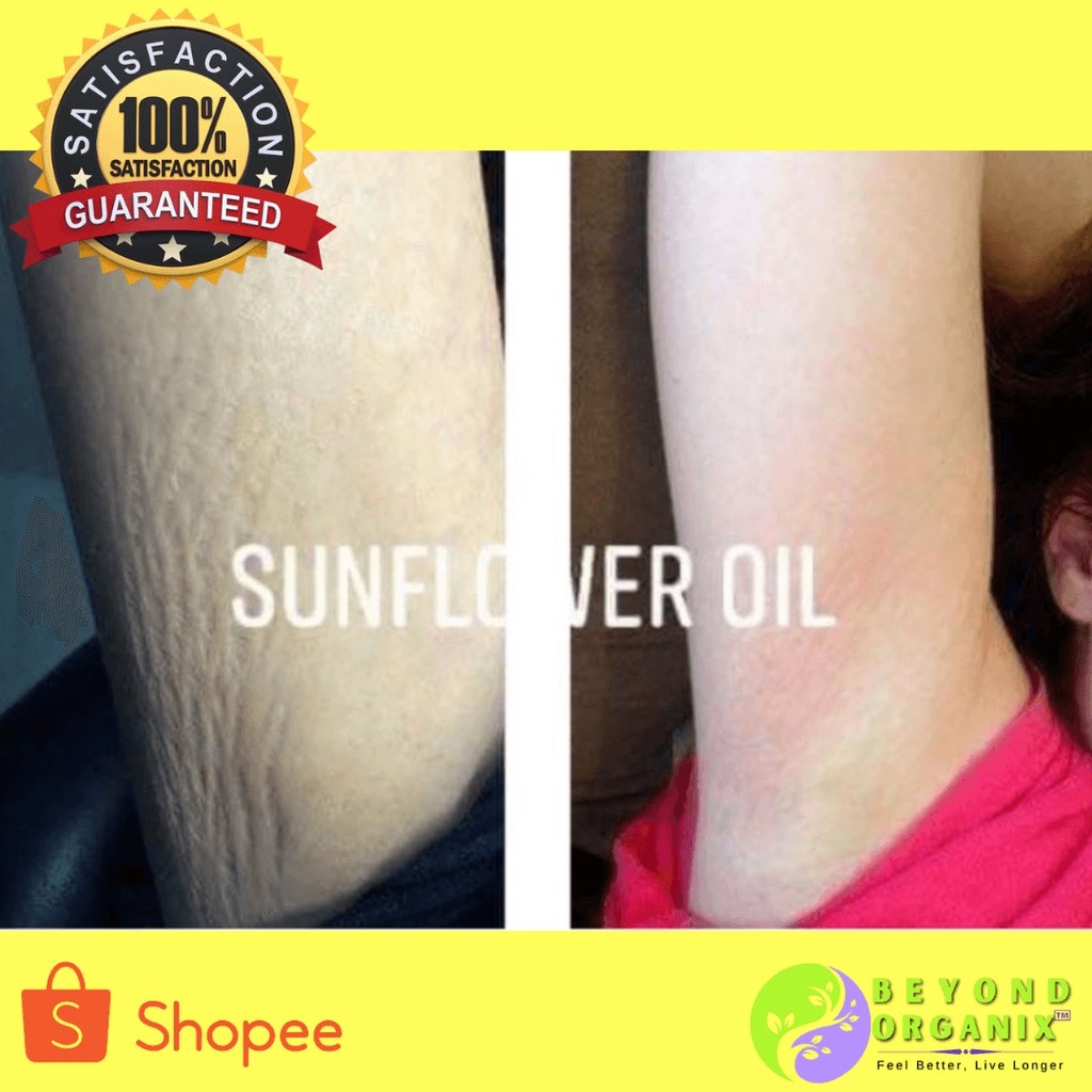 Beyond Organix SUNFLOWER OIL SOAP Duo (Inguinal and armpit lightener Pimple stretch mark care