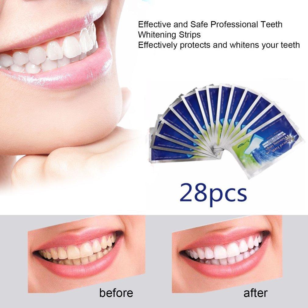 How Much Teeth Bleaching Cost In Philippines TeethWalls