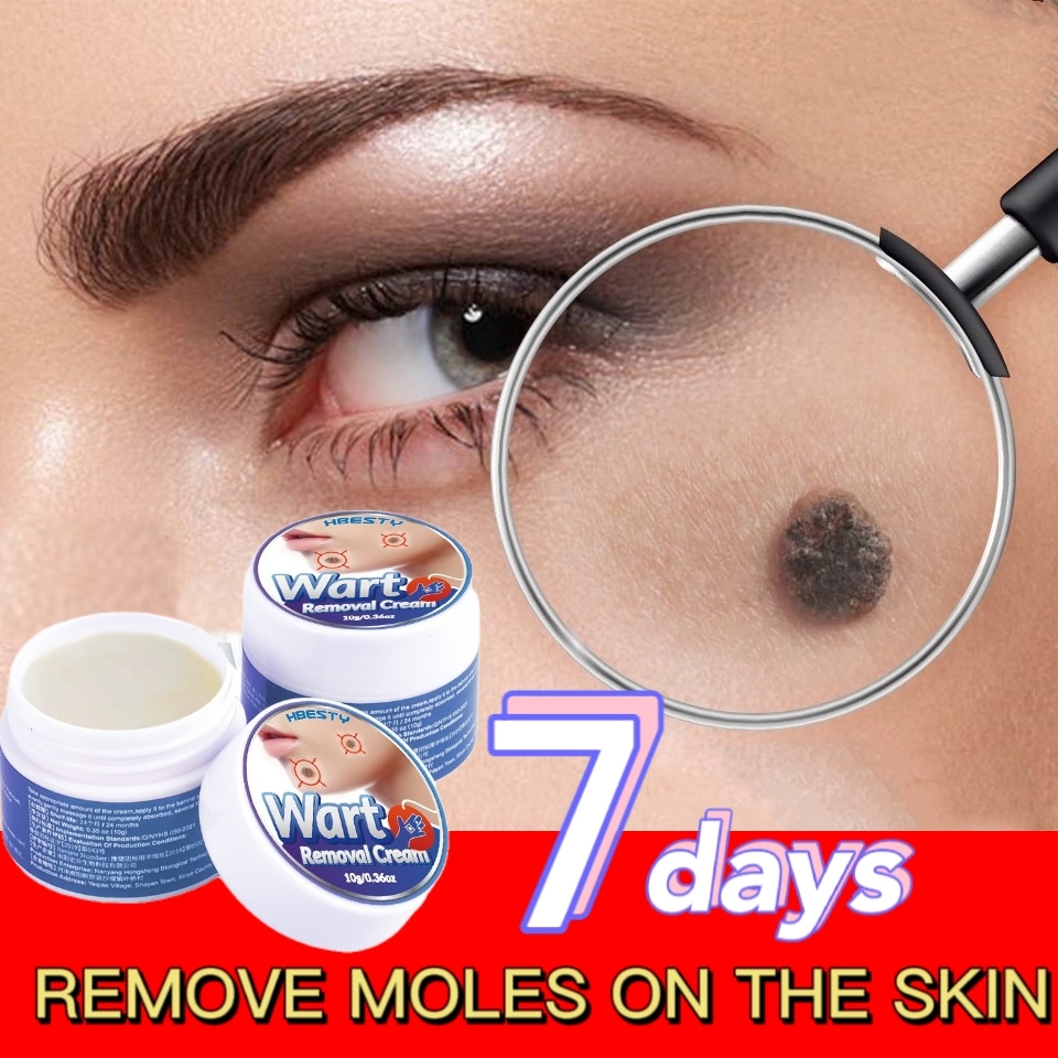 Wart Removal Cream Original Watson Facial Skin Care Tool Skin Tag
