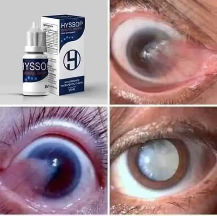 Original Hyssop Mineral Drops 15 Ml Eye Problem Remedy Glaucoma Cataract Eye Floaters Sore Eyes Treatment Eye Cleanser Eye Drops All Natural And Organic Lazada Ph