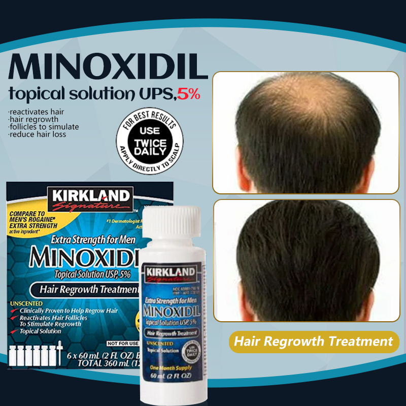 minoxidil hair grower for men original hair grower for women effective ...