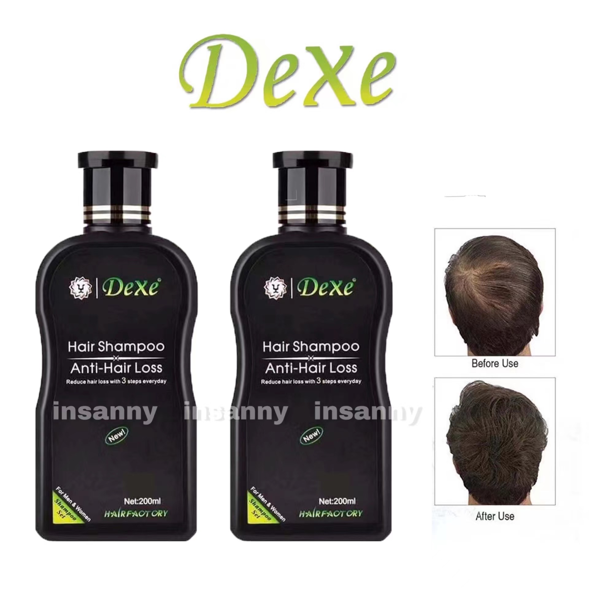 ( Set of 2 ) DEXE Hair Growth Stimulating Shampoo Anti-Hair Loss Hair ...