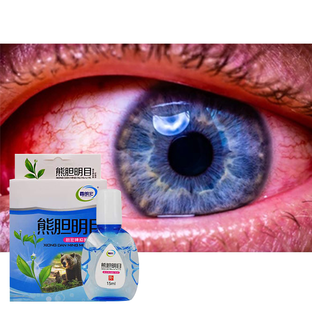 Eye Drops for Clear Vision Blurred Vision Cataract Treatment Itchy