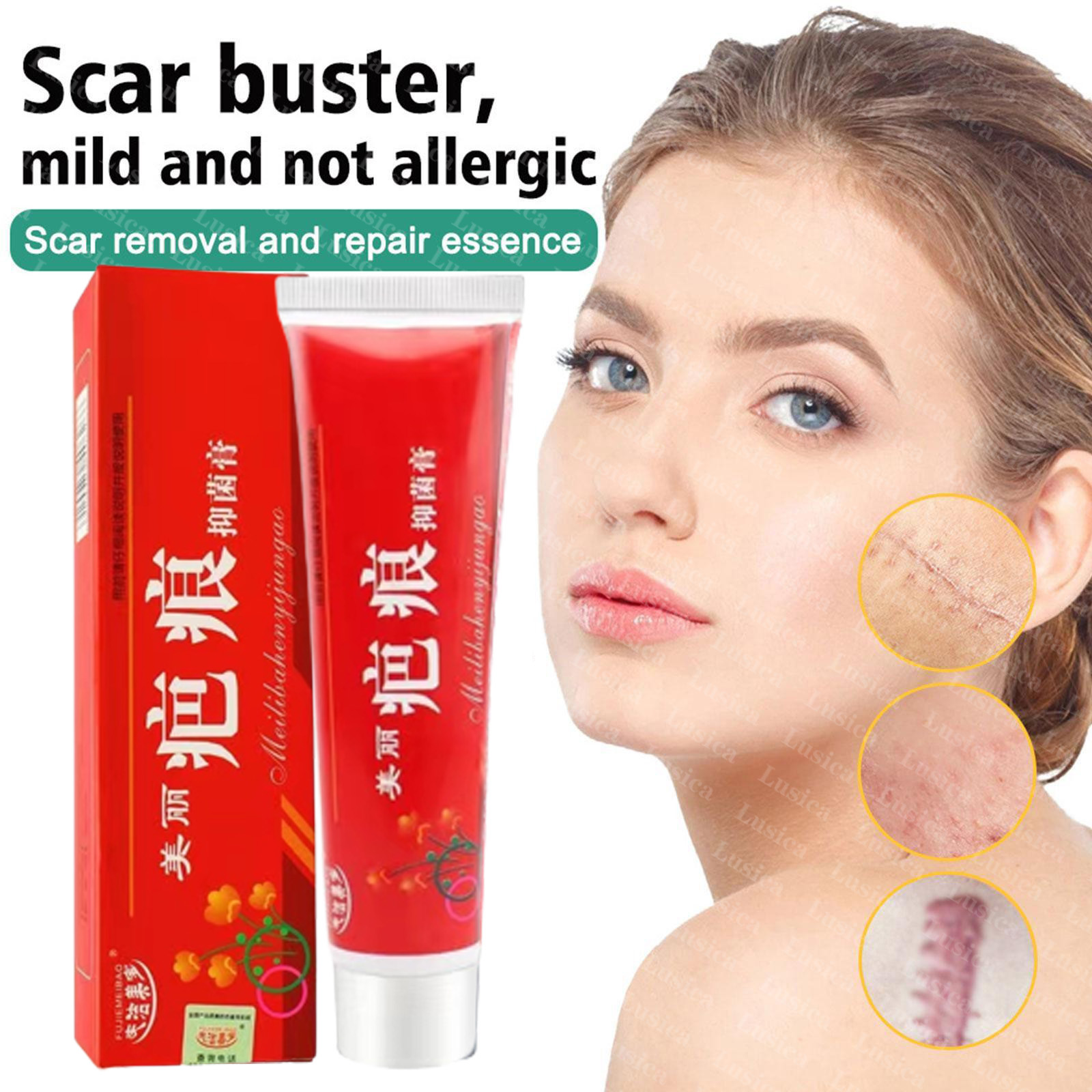 100 Original Scar Repair Cream Fast treatment of all scars Scar Fades