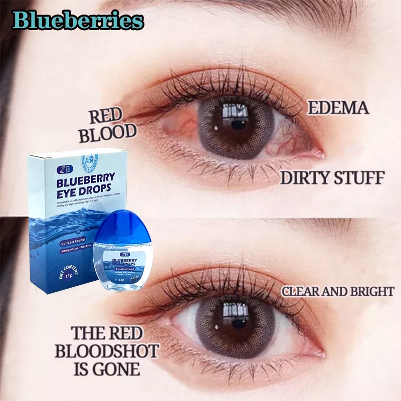 blueberries-eye-drops-original-eyedrops-eye-drops-for-clear-vision