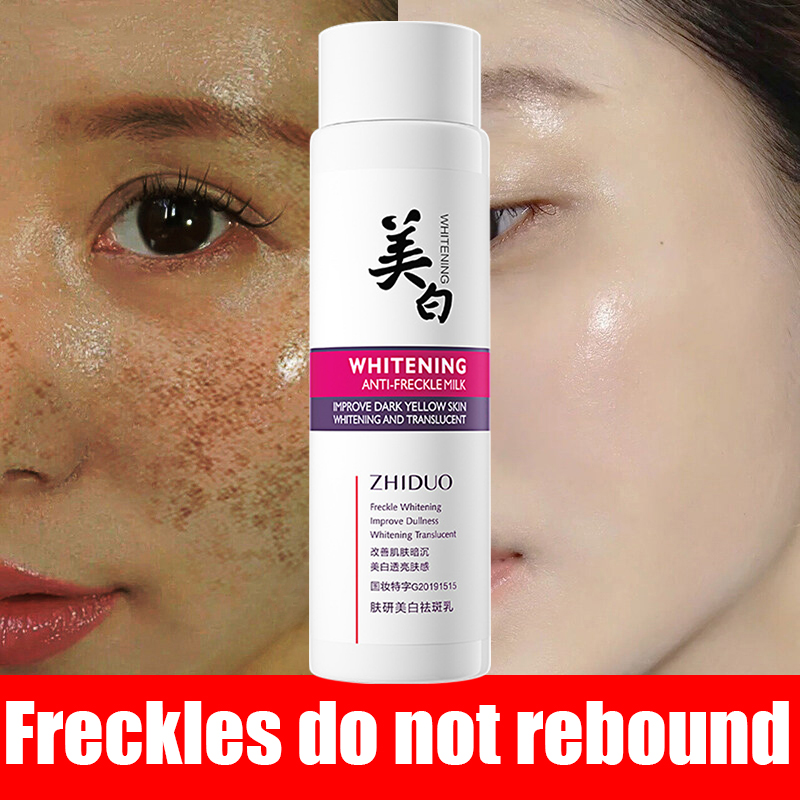 【3 Days Effective】Effective Whitening Freckle Cream Original ...