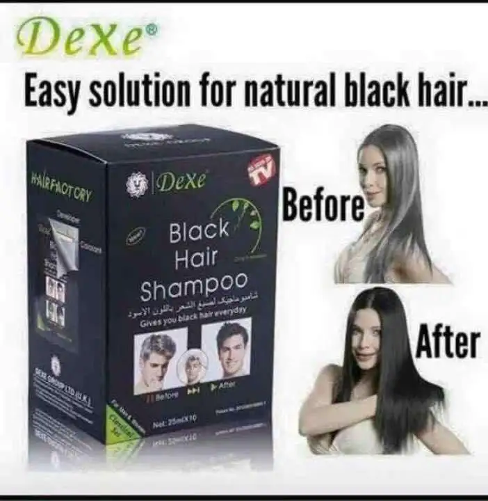 Mz Adizai Dexe Black Hair Shampoo 25mlx10 Lazada Ph