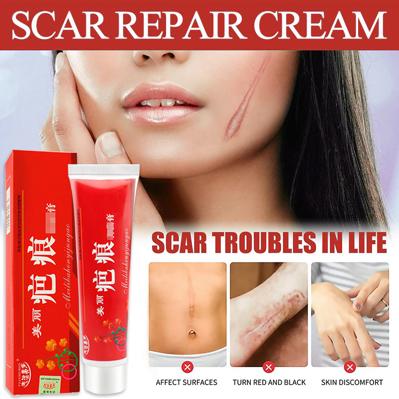 100 Effective Scar Repair Cream Scar cream Remover Surgery Scar Insect Bites Mark Acne Spots