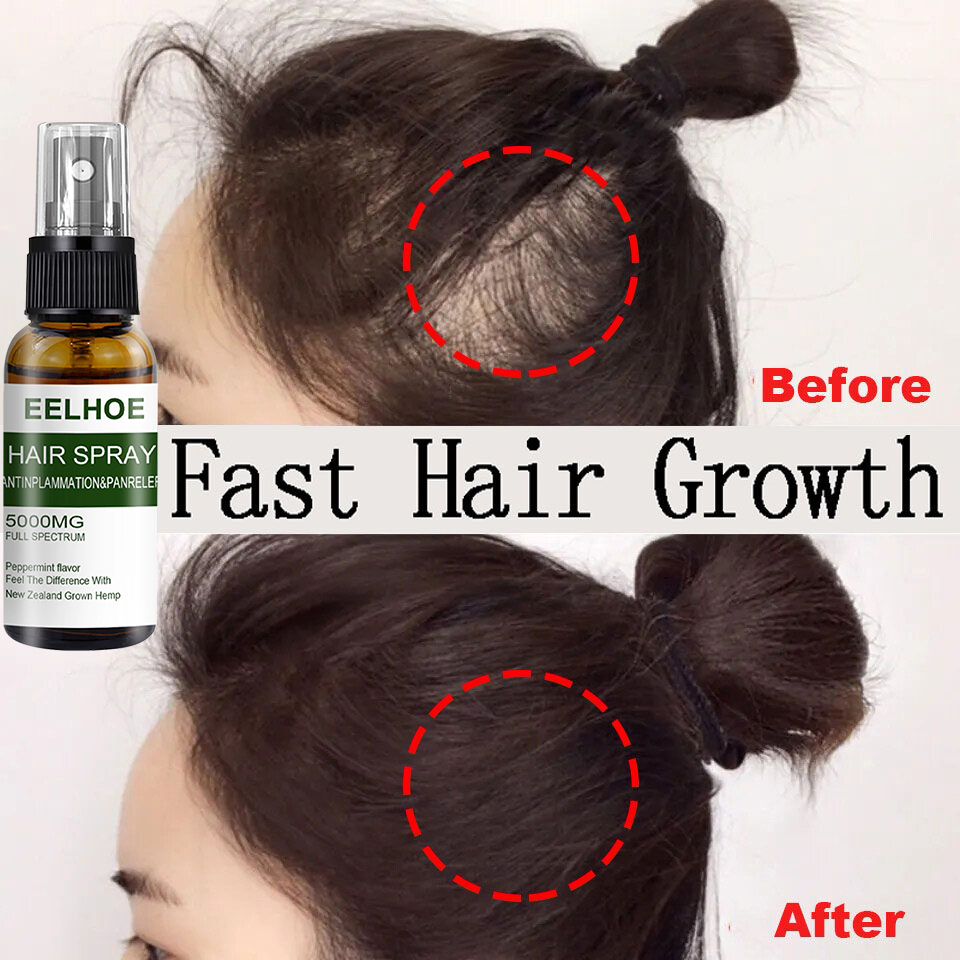 ⚡THICKER HAIR IN 7 DAYS⚡EELHOE Hair Growth Spray 50MLFast Powerful Hair  Grower Hair Care 100% Pure Natural Treatment Hair Loss Hair Grower for Men  and Women hair grower for men original ​purc