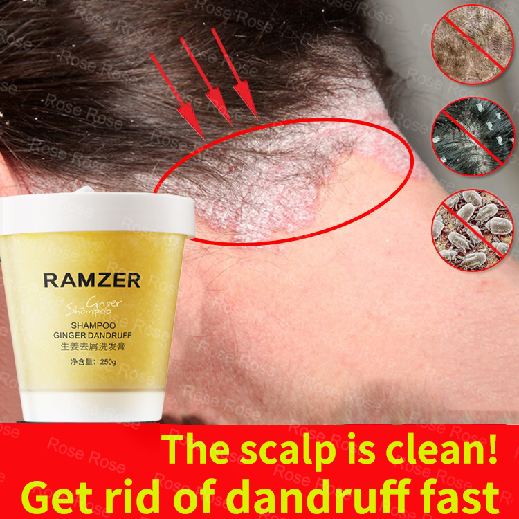 Ginger Anti Dandruff Shampoo For Dandruff and Scalp Treatment Ginger