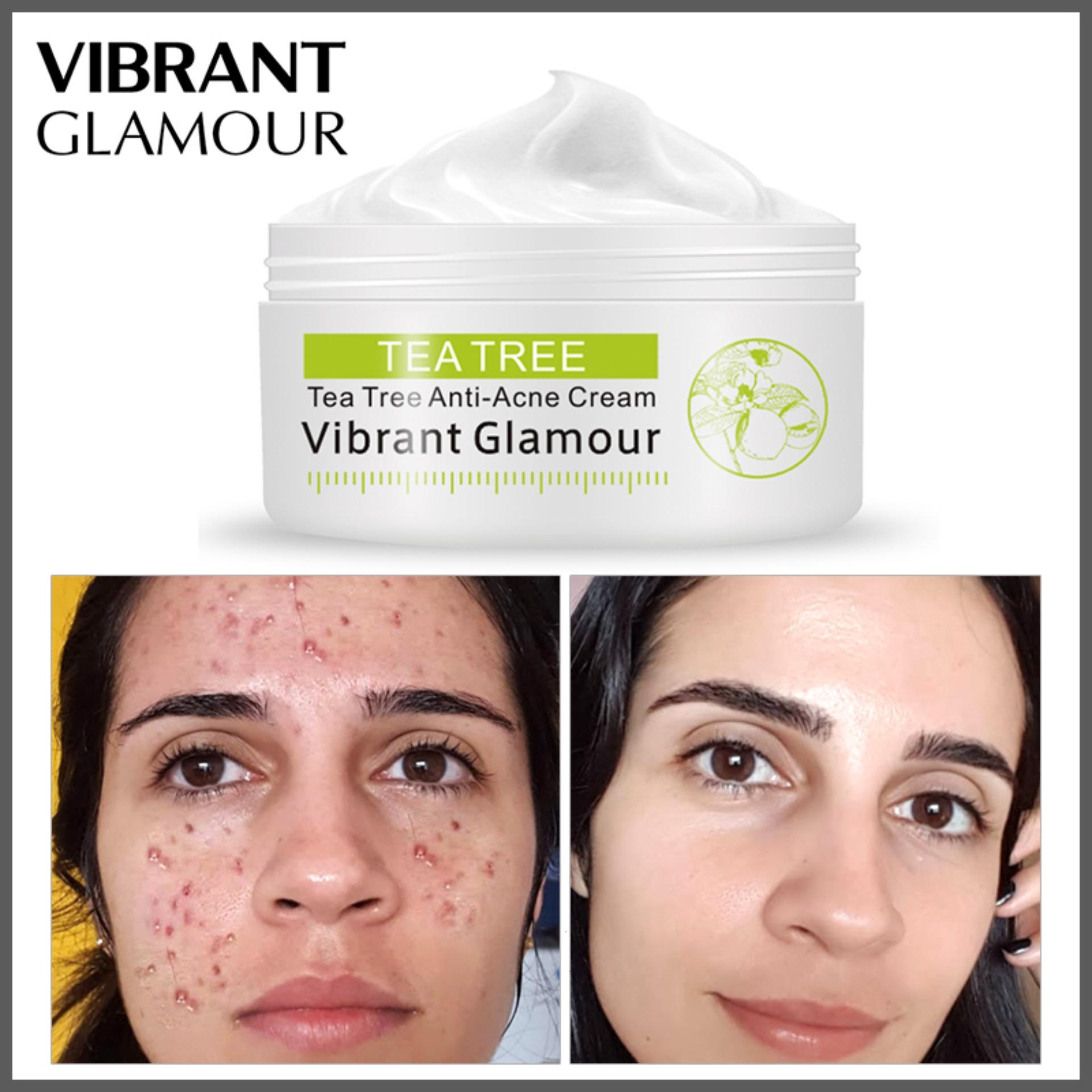 Vibrant Glamour Tea Tree Anti Acne Face Cream Oil Control Shrink Pores Acne Cream Nourish Whitening Acne Scar Remove Skin Care Lazada Ph