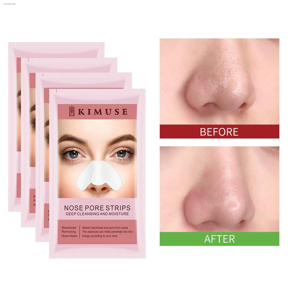 KIMUSE Nose Pore Strips Deep Cleansing and Moisture Lazada PH