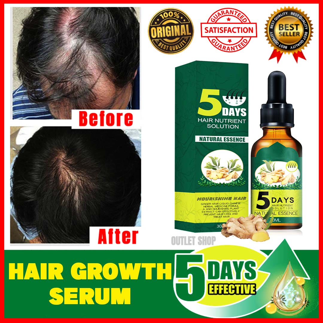 👩‍🦱 ⚡️ 100 % Original TOP SELLING Hair Growth⚡️ Serum Ginger Extract  Prevent Baldness Moisturize the Scalp Hair Growth Hair Growth Serum for Men  and Women Hair Loss Treatment Essence Hair Growth