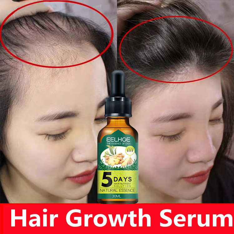 Efero Hair Growth Anti-Hair Loss Glory Glam Products | Efero 20ml Fast  Powerful Hair Growth Oil Hair Loss Products Essential Oil Grow Restoration  Growing Serum Hair Care 