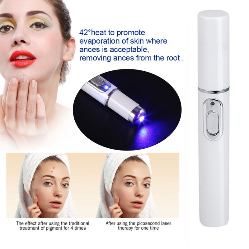 blue laser facial treatment