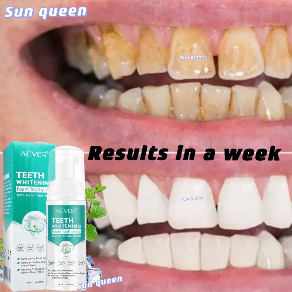 ALIVER Teeth Whitening Teeth Cleaning Mousse White Teeth Oral Hygiene Toothpaste Whitening