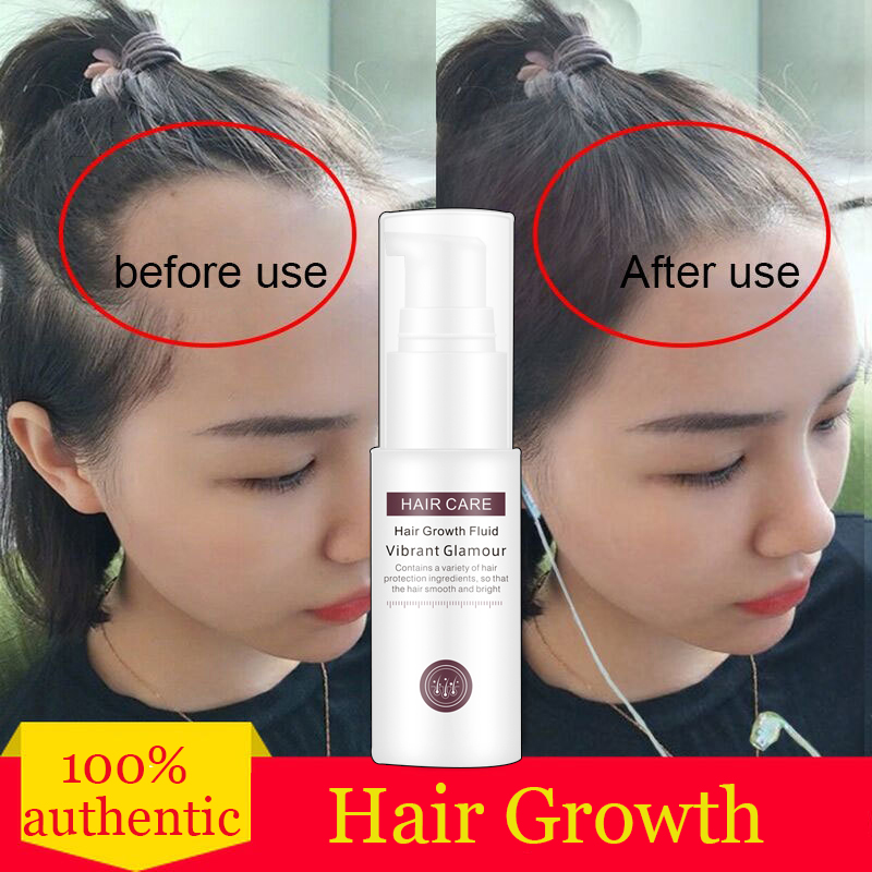 Hair Growth Essence VG Essential Oil Liquid Spray Nourish Roots Thick Shiny  Prevent Hair Loss Anti-hair | Lazada PH