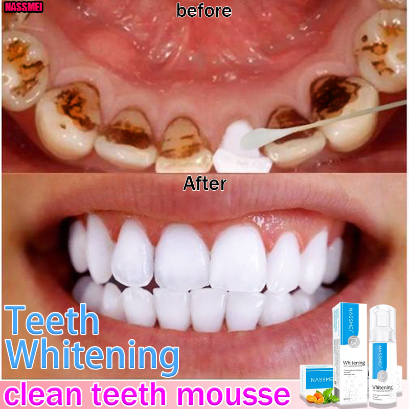 nassmei dental mousse