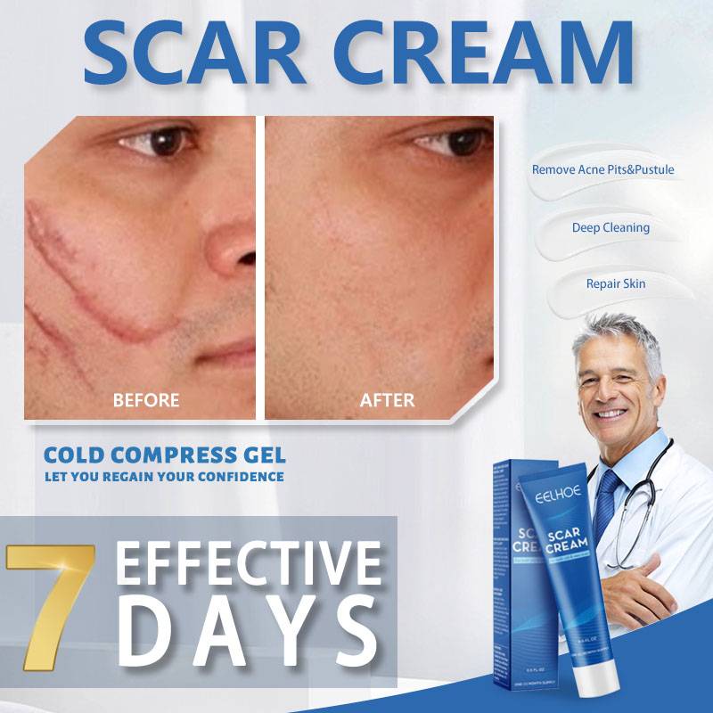 fix scar removal original scar remover for old scar on leg strechmark