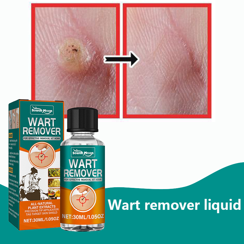 Wart Remover Essence Plantar Wart Removal Common Wart and Flat Wart