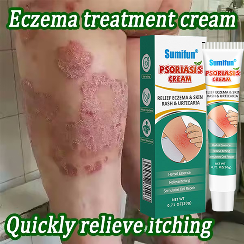 Psoriasis eczema treatment cream 20g atoderma cream ointment for itchy