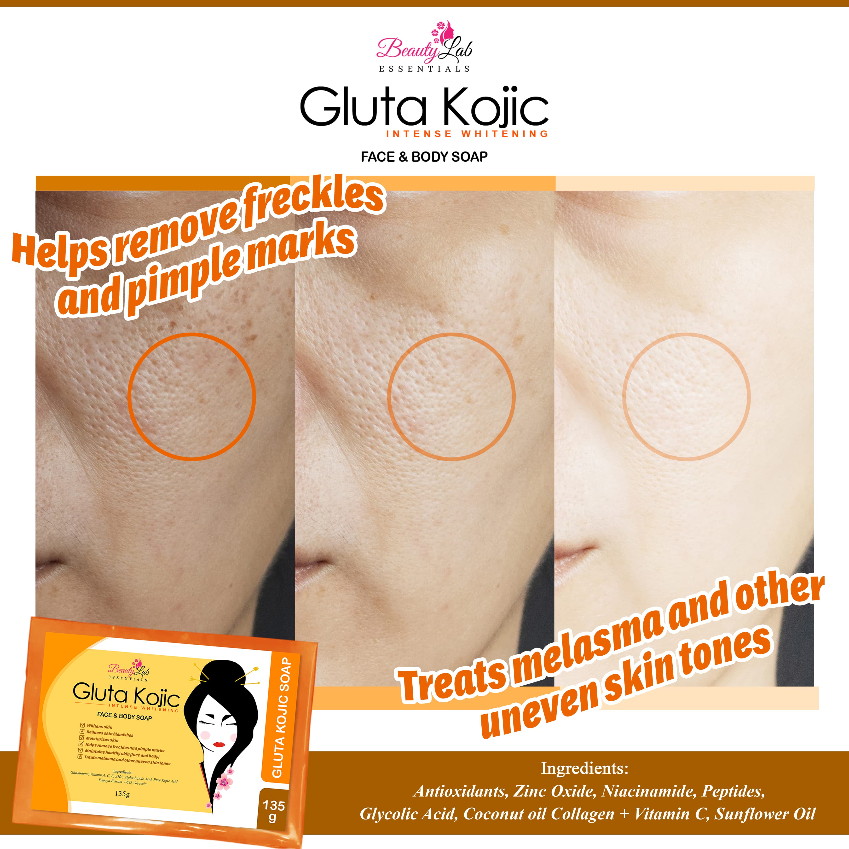 Beautylab Essentials Gluta Kojic Soap 135 Grams Original Vitamins