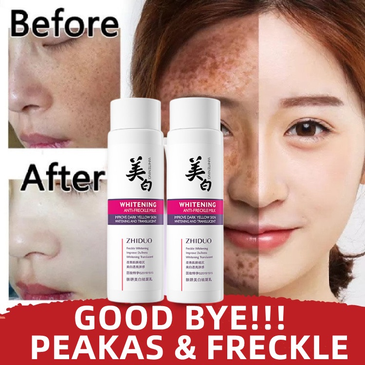 Effective Whitening Niacinamide Freckle Cream Hydrating Moisturizing