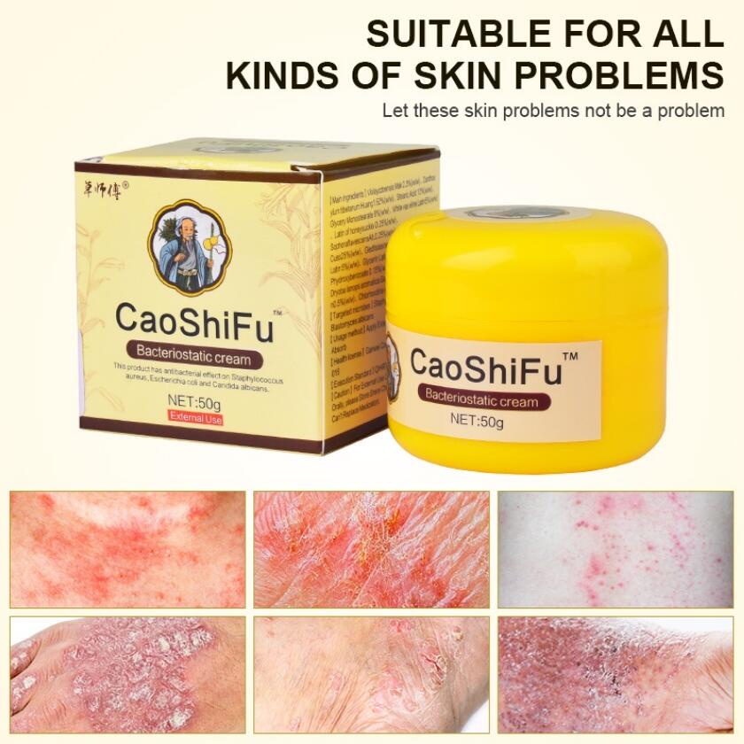 Caoshifu Psoriasis Eczema Cream For Skin Problems Body Massage Ointment Chinese Herbal Medician 1830