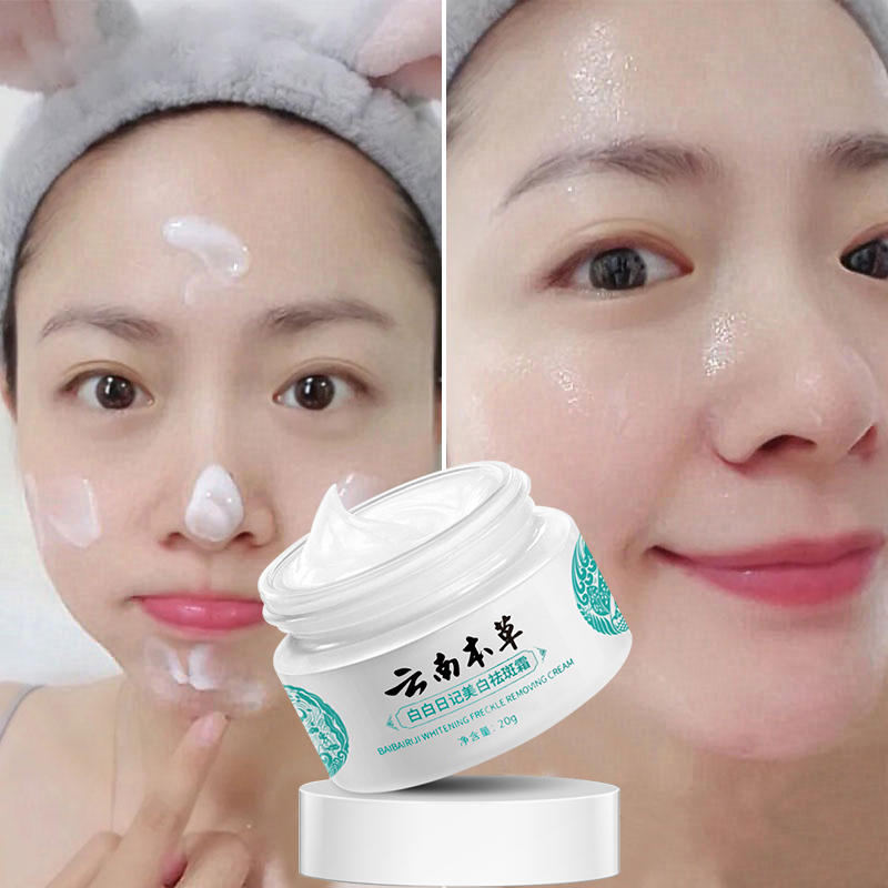 Yunnan Materia Medica Melasma Cream Whitening Freckle Cream Pekas ...