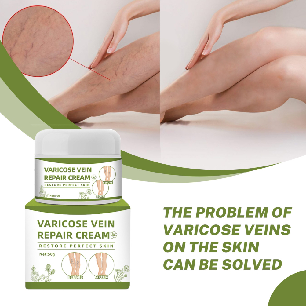 Crème Pour Varices — Favorise La Circulation Sanguine Et Raffermit La Peau, Soin Des Jambes, Produit Neuf