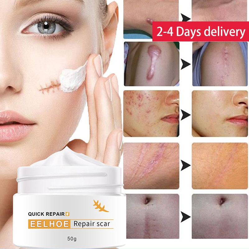 Original EELHOE Scar Removal Cream For Old Scars 50g Remover Cream for