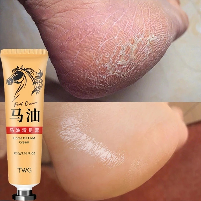 Monfince Foot Cream Horse Oil ,Best Callus Remover for Feet, Knees& Elbows,Natural Moisturizes Nourishes Softens Dry, Rough, Cracked, Dead Skin , 30g