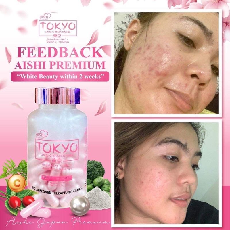 aishi tokyo glutathione fake vs original Tokyo: vs. Review Are these bottles of glutathione