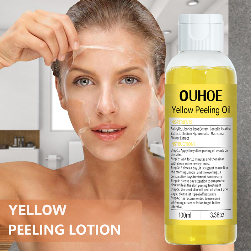 100 Original Effective Yellow Peeling Oil 100ml Peeling Lotion Body Peeling Face Peeling 5121