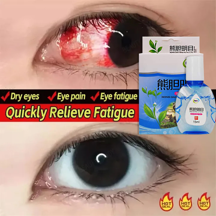 🔥100% Original🔥eye drops, dry eyes, bloodshot eyes, blurred eyes, red ...