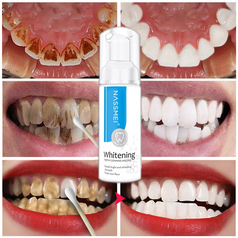 nassmei dental mousse review