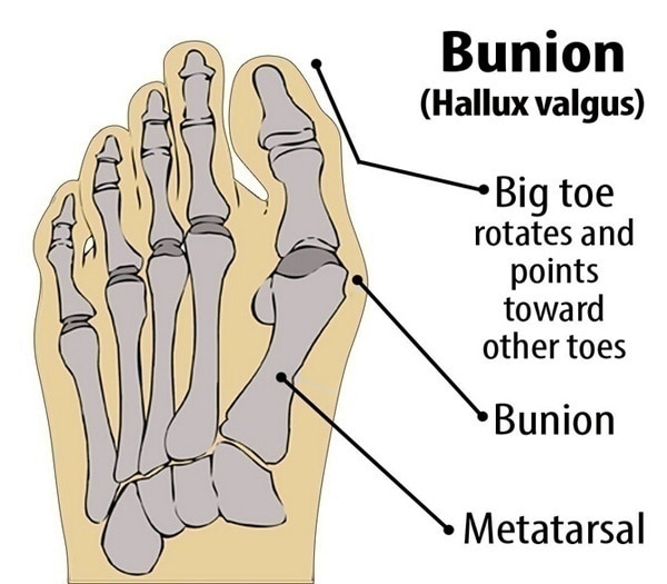 Toes Separator Socks Thumb Adjuster Straightener Feet Bone