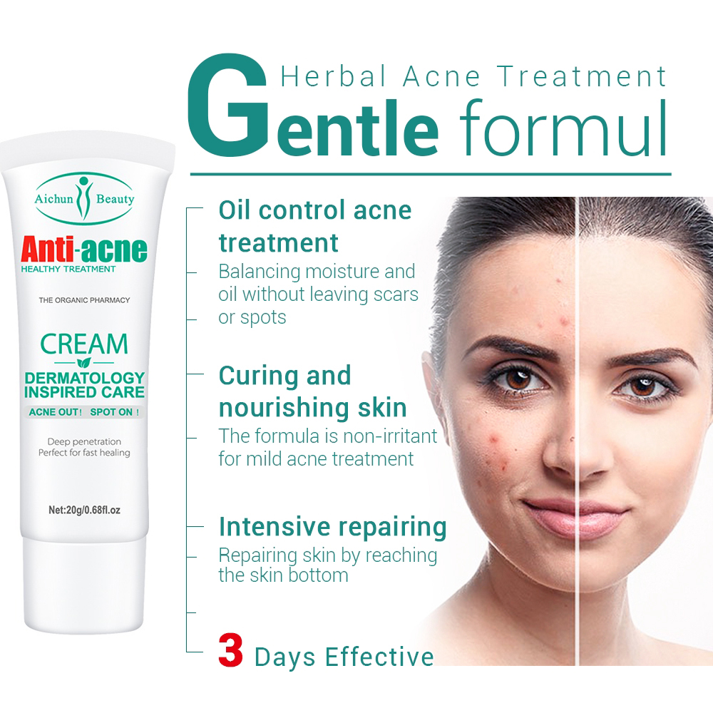 Antiacne cream acne remover treatment brightening moisturizing skin