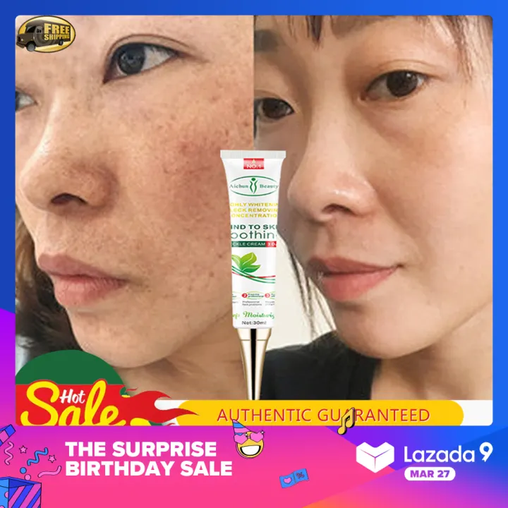 miracle cream for melasma
