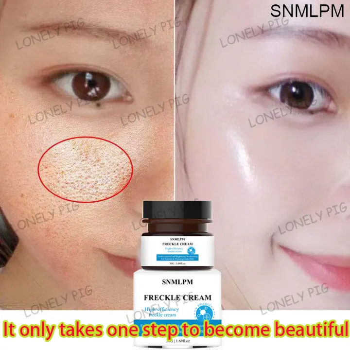 snmlpm freckle cream