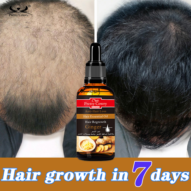 30Ml Hair Follicle Growth Solution Professional Nourish Hair Roots Anti Hair  Loss Hair Care Supplies For Women Men New Plant Hair Treatment 30Ml | 30ml Hair  Follicle Growth Solution Nourish Hair Scalp