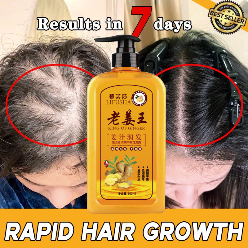 500ml Original Ginger Shampoo Fast Powerful Hair Growth Liquid Anti Hair Loss Shampoo Repair 0588