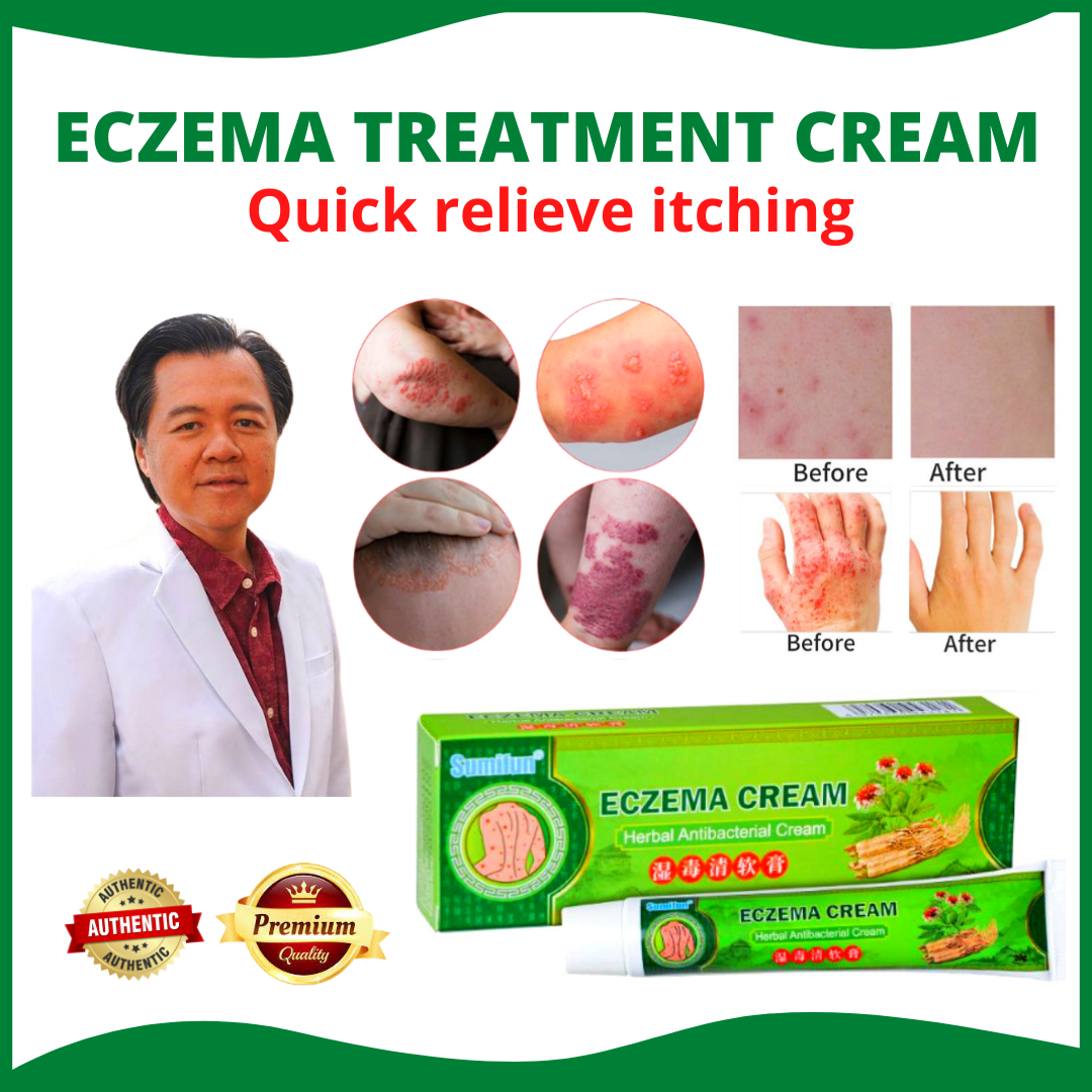 👍 100% ORIGINAL & Effective Eczema Treatment herbal antibacterial cream ...