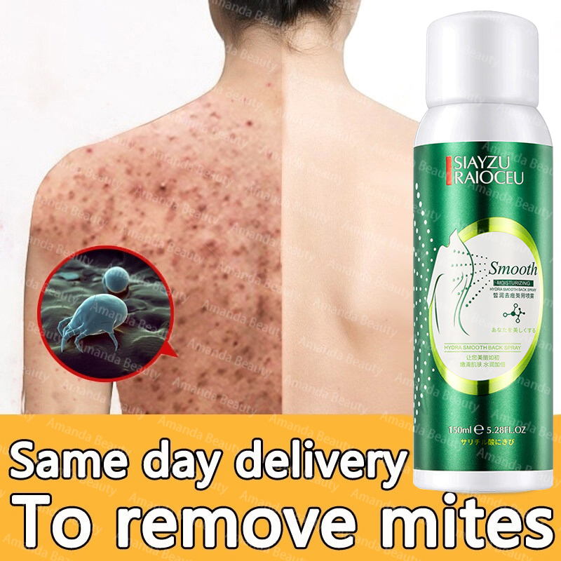 back-acne-treatment-spray-antibacterial-anti-acne-gentle-exfoliating