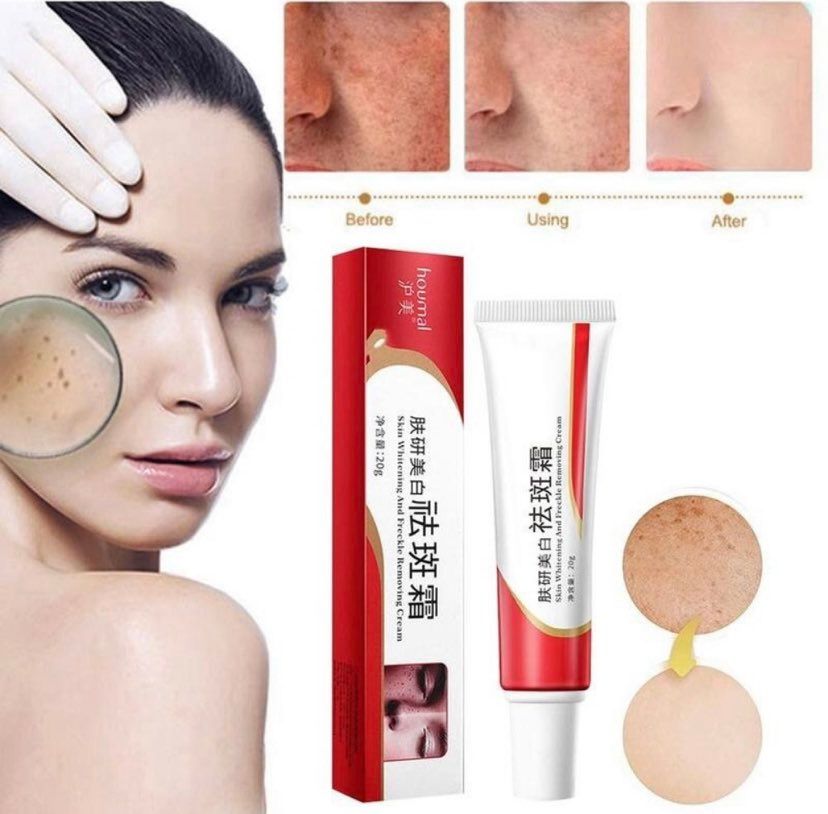 Pekas Remover Effective Melasma Cream Anti Freckle Collagen Original ...