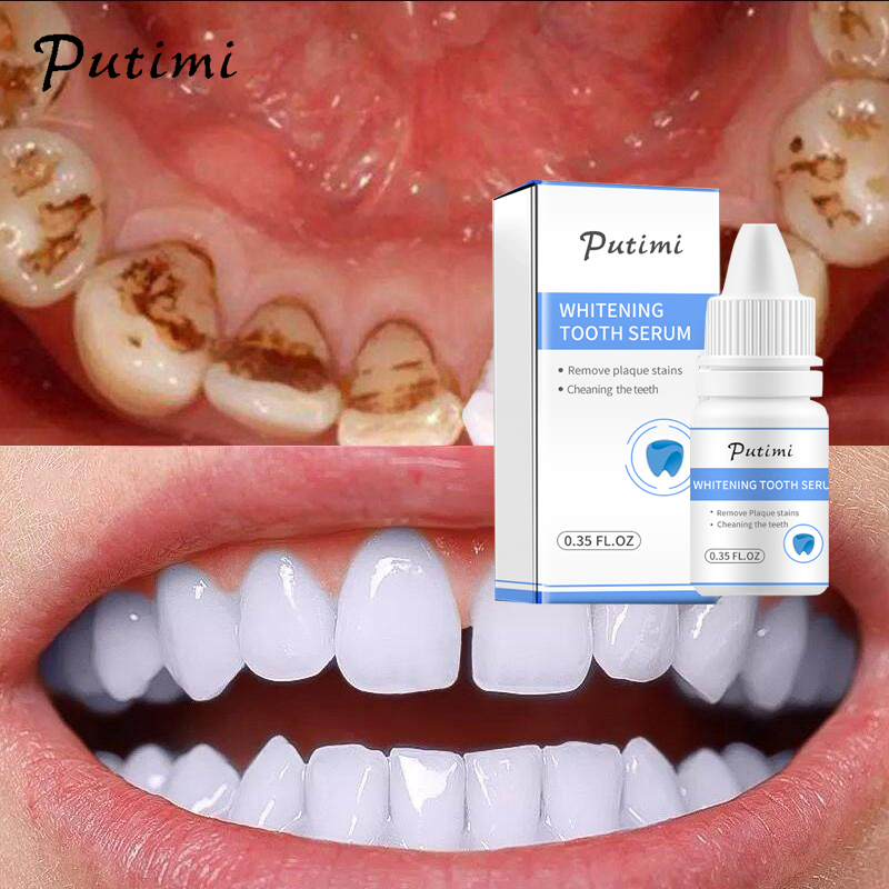 Putimi teeth whitening Clearance