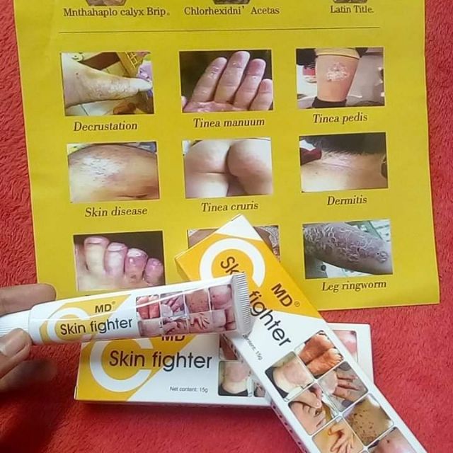 skin fighter for pimples