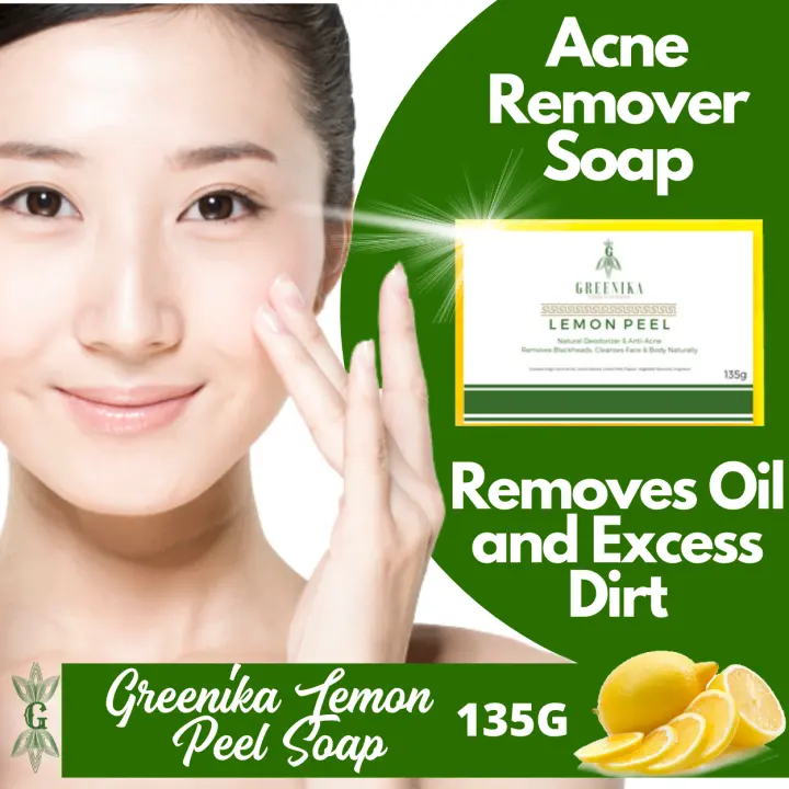 best oil for acne treatment